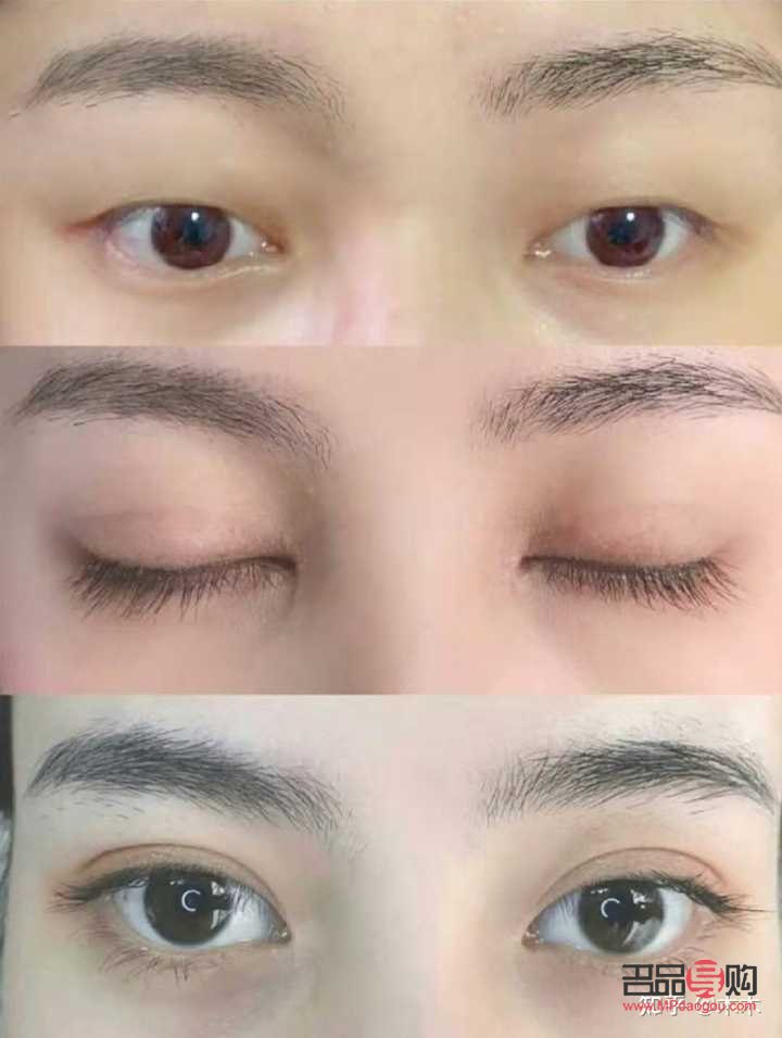 哪里雙眼皮好啊(哪里雙眼皮好啊女生)