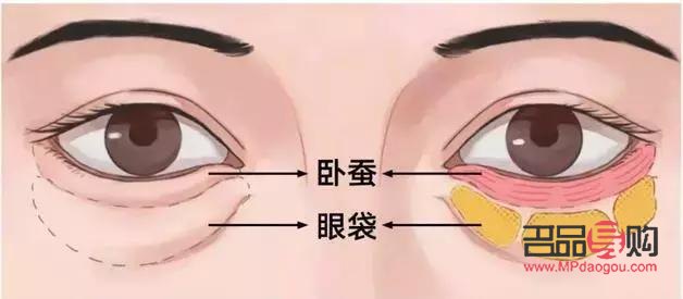 淚溝和眼袋有啥區(qū)別(淚溝和眼袋有啥區(qū)別呢)