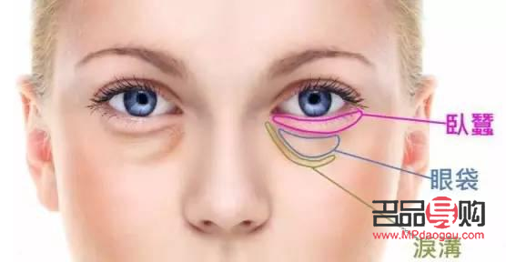 淚溝和眼袋有啥區(qū)別(淚溝和眼袋有啥區(qū)別呢)