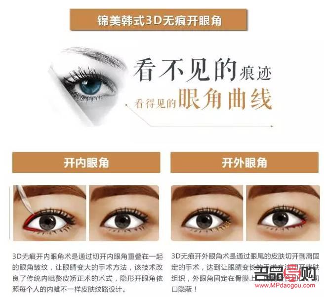 <h3>雙眼皮割窄了如何補救？女性專屬指南</h3>