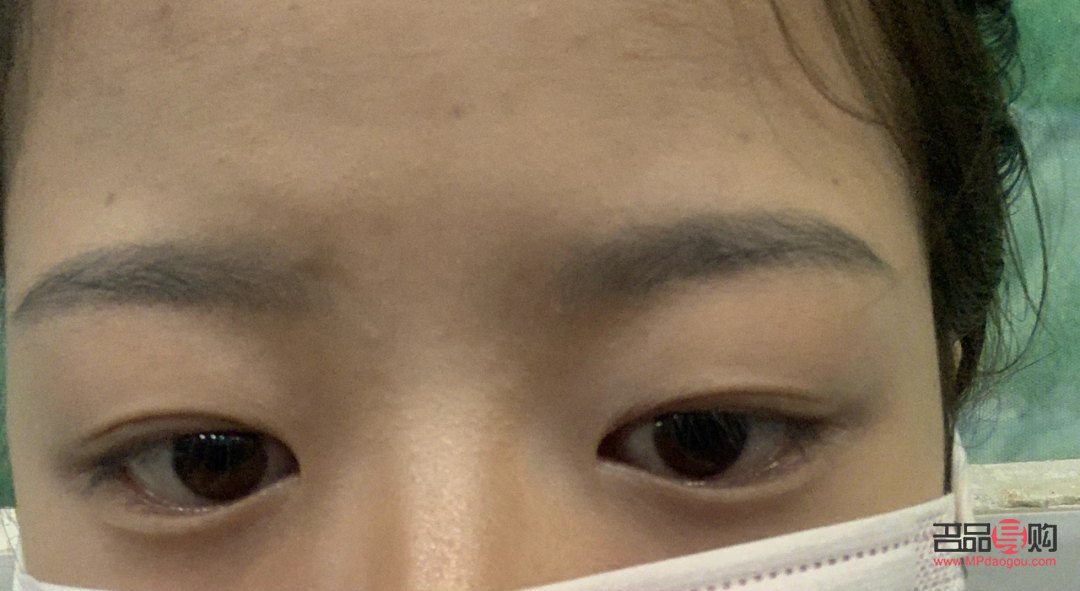 <h3>腫眼泡是怎么回事？</h3>