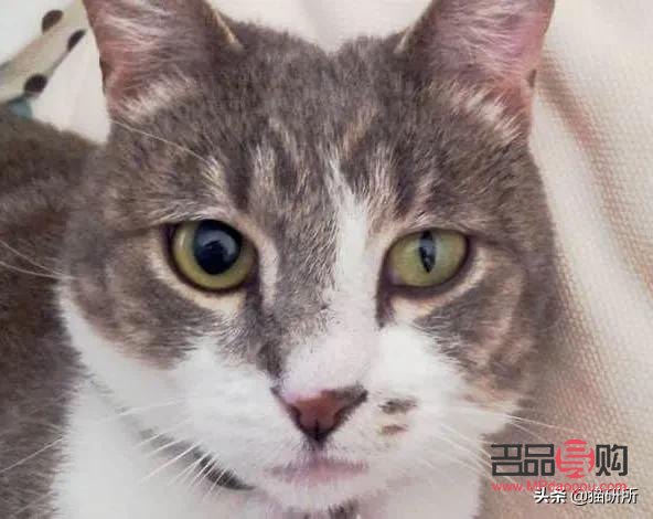 眼睛一大一小正常嗎(人的眼睛一大一小正常嗎)