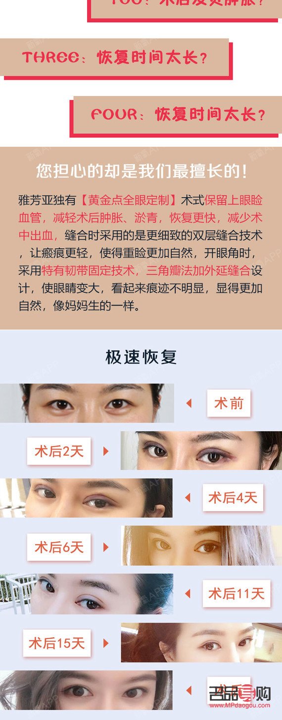 <h3>5G桃花眼雙眼皮手術(shù)風(fēng)險(xiǎn)解析</h3>