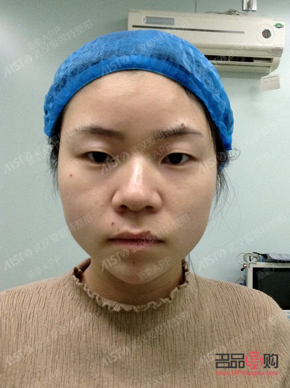 大眼綜合和小眼綜合哪個(gè)好看(大眼綜合和小眼綜合哪個(gè)好看點(diǎn))