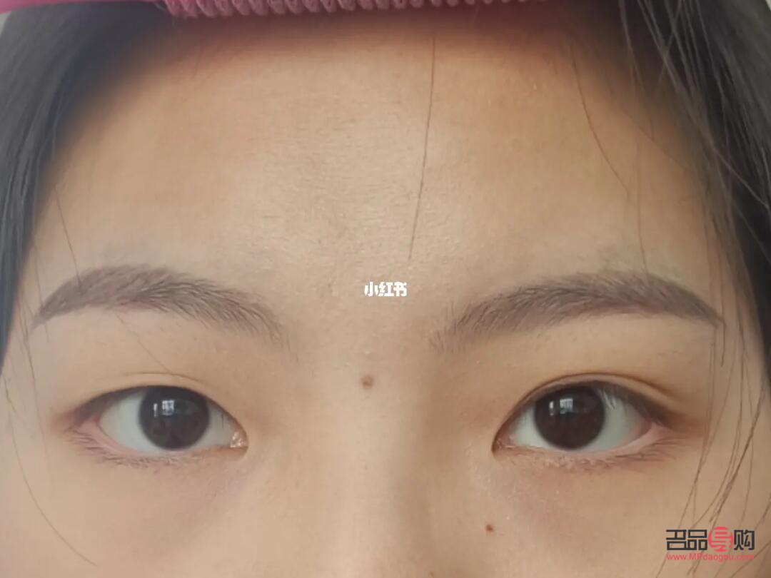 天生一單一雙眼皮怎么辦(天生一只雙眼皮一只單眼皮怎么辦)