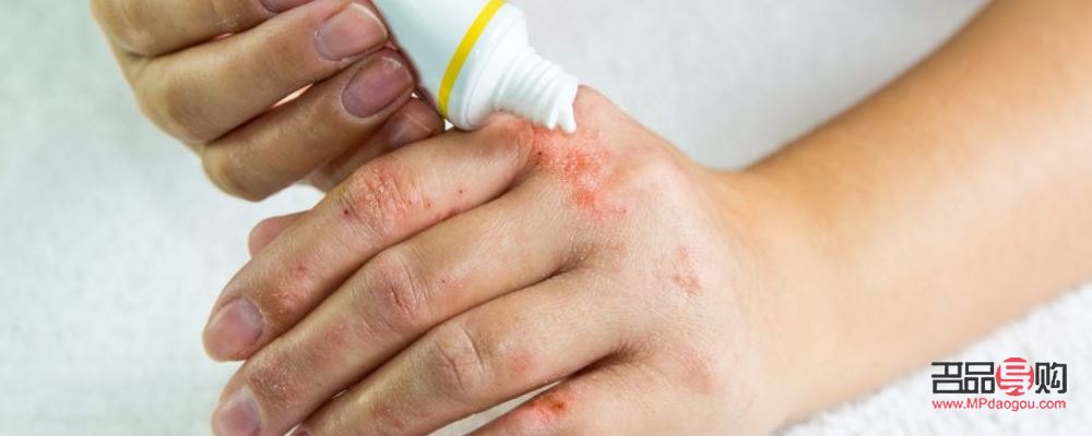 身體上長(zhǎng)濕疹怎么護(hù)理(身體長(zhǎng)濕疹怎么調(diào)理)