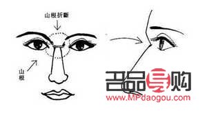 男人眼泡浮腫的面相(男人眼泡浮腫的面相圖解)