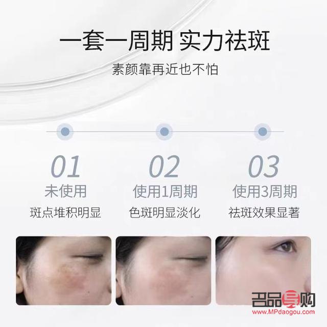 美容院祛斑全攻略：專業(yè)、安全、高效