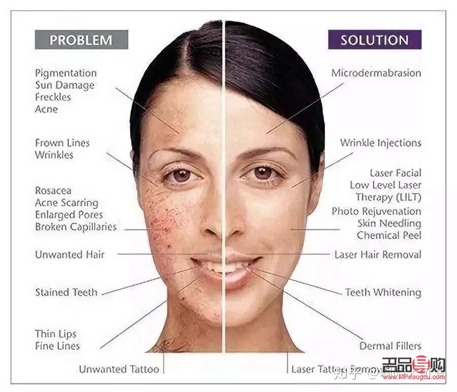 <h3>眼部抗衰對比圖揭示的保養(yǎng)秘訣</h3>