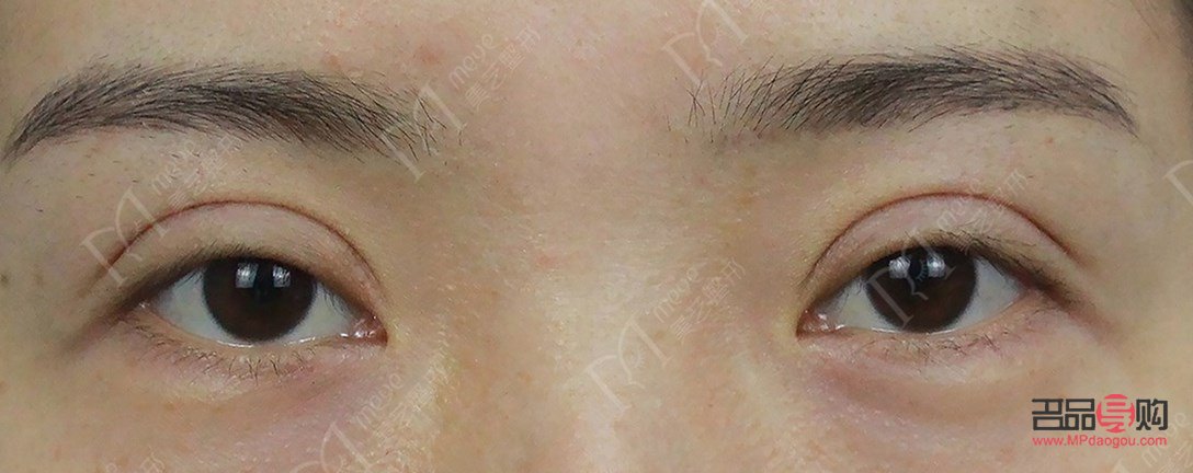 扇形雙眼皮給人的感覺(jué)(扇形雙眼皮給人的感覺(jué)怎么樣)