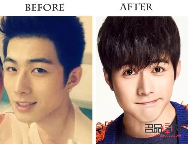 男的割雙眼皮多嗎(男的割雙眼皮多嗎知乎)