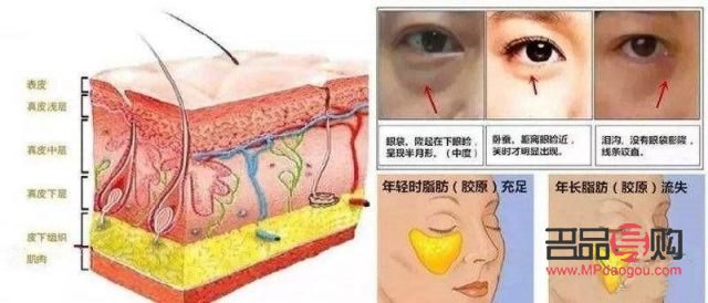 <h3>探究眼袋成因及治療方法</h3>