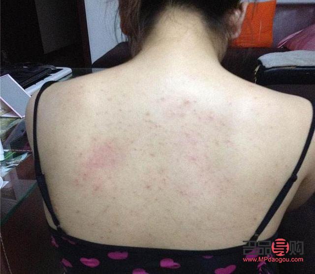 <h3>身體乳涂抹技巧與后背護(hù)理全攻略</h3>