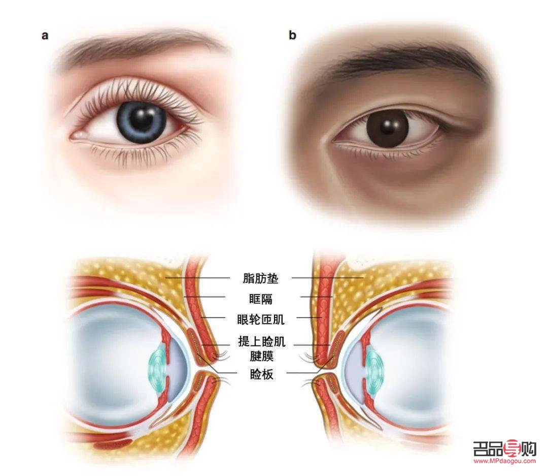 <h3>雙眼皮種類圖解大全：了解雙眼皮的多樣性與魅力</h3>