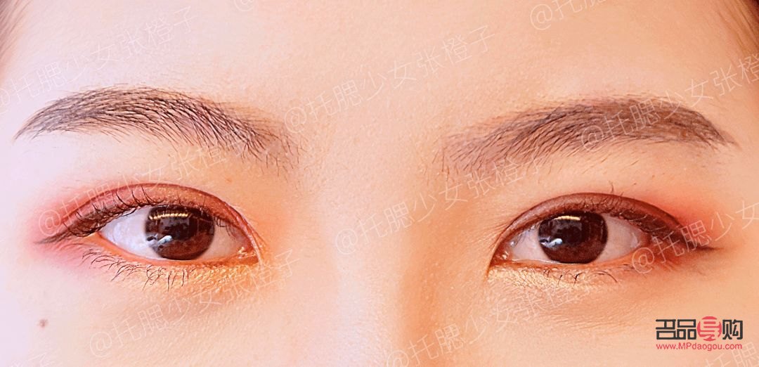 雙眼皮手術(shù)帶來的巨大變化：如何應(yīng)對與接受自我新面貌