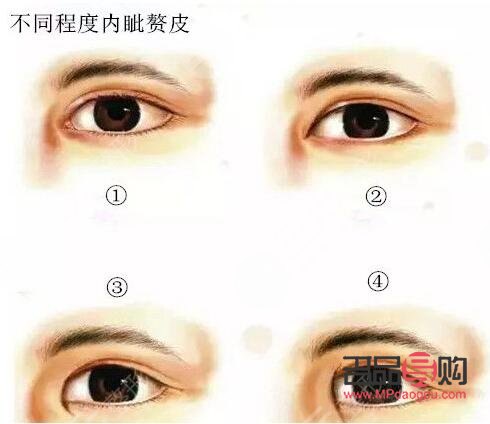 眼皮松全切雙眼皮會(huì)不會(huì)塌(眼皮松全切雙眼皮會(huì)不會(huì)塌下去)