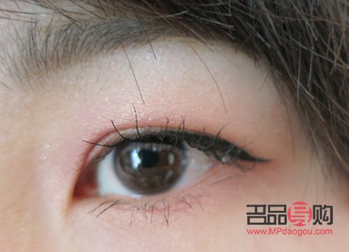 <h3>腫眼泡問題解決方案：適合的手術(shù)方法探討</h3>