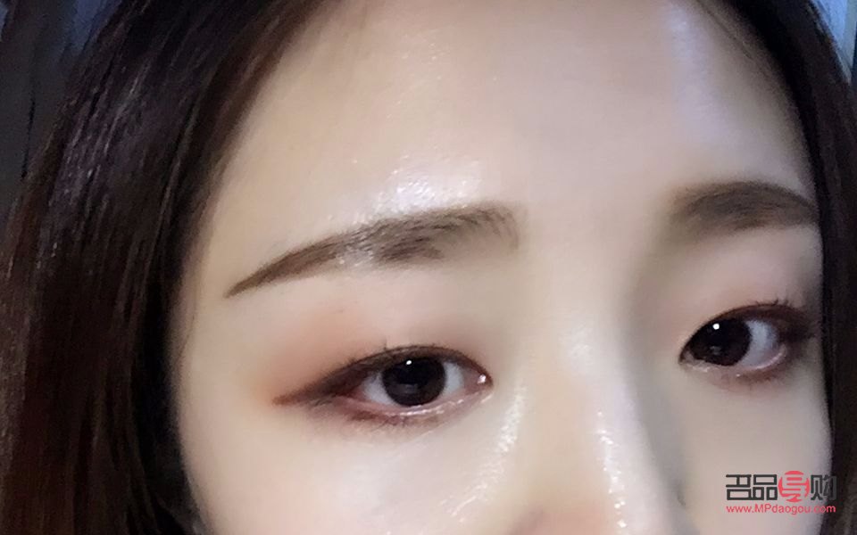 提拉眼皮術后多久恢復(提拉眼皮術后多久恢復自然)