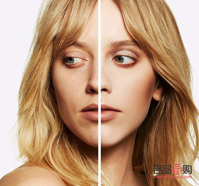 告別沉重眼袋，重拾青春明眸