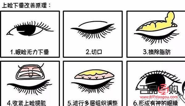 眼瞼肌無力吃什么藥(眼瞼肌無力吃什么藥最好)