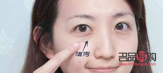 眼窩凹陷嚴(yán)重圖片(眼窩凹陷嚴(yán)重圖片兒童)