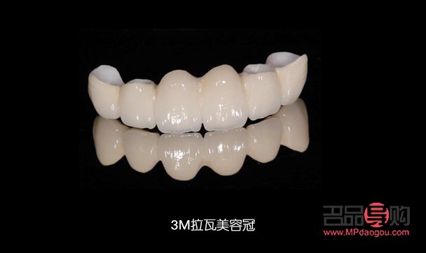 美容冠怎么樣(美容冠怎么樣好看)