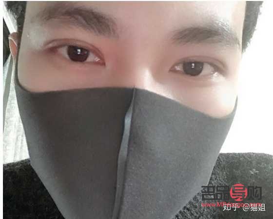 <h3>男人是否應該割雙眼皮？探討男性雙眼皮手術的利與弊</h3>