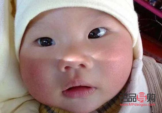 斗雞眼可以矯正嗎(天生斗雞眼可以矯正嗎)