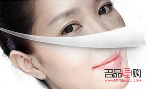 眼部超聲刀怎么做(眼部超聲刀做完什么時候見效果)