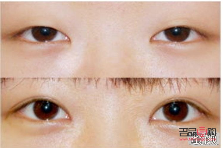 <h3>從內(nèi)雙到外雙：打造迷人雙眼皮的秘訣</h3>