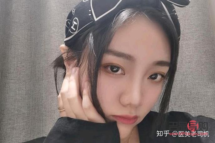 西安眼部整形醫(yī)生(西安眼部整形醫(yī)生排名)