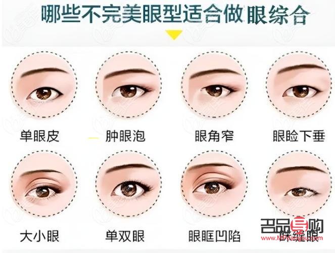 現(xiàn)在流行什么雙眼皮技術(現(xiàn)在流行什么雙眼皮技術呢)