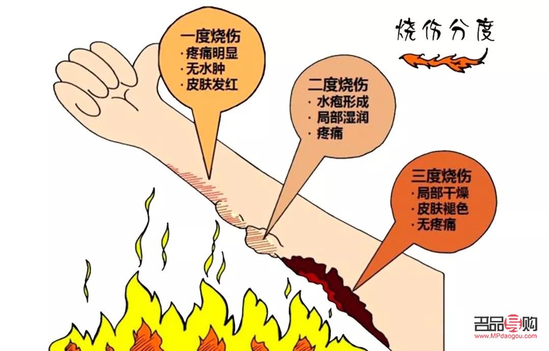 身體燙傷怎么護(hù)理好(身上燙傷)