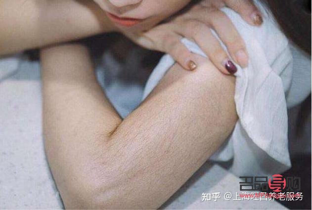 身體毛發(fā)怎么護(hù)理(身體毛發(fā)怎么護(hù)理好)