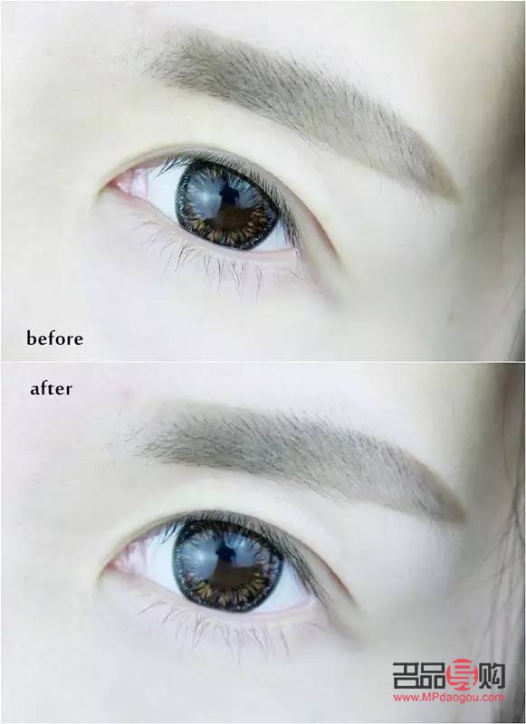 眼睛腫脹導致眼睛變小，如何應對？