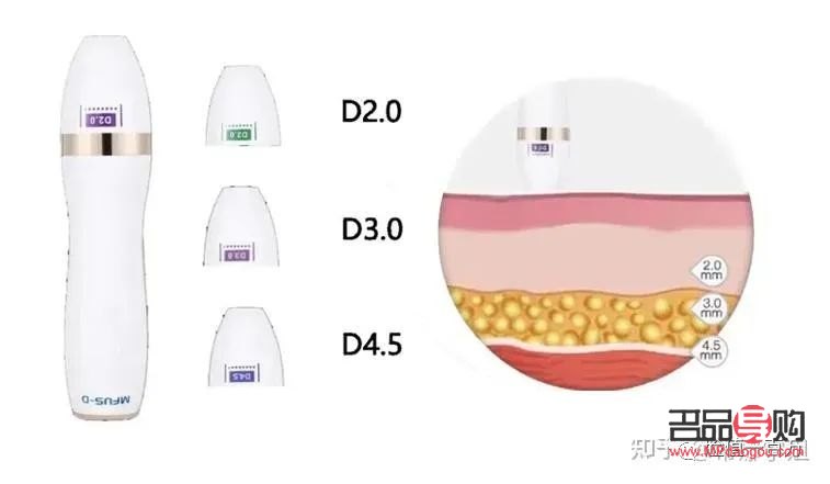 <h3>眼部超聲炮：重塑青春明眸，價格與價值并存</h3>