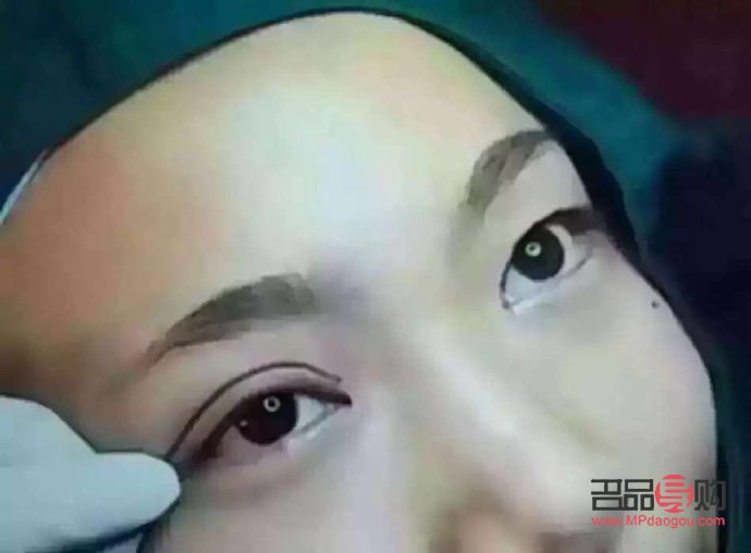 <h3>雙眼皮定位解析：了解雙眼皮美容手術(shù)的關(guān)鍵一步</h3>