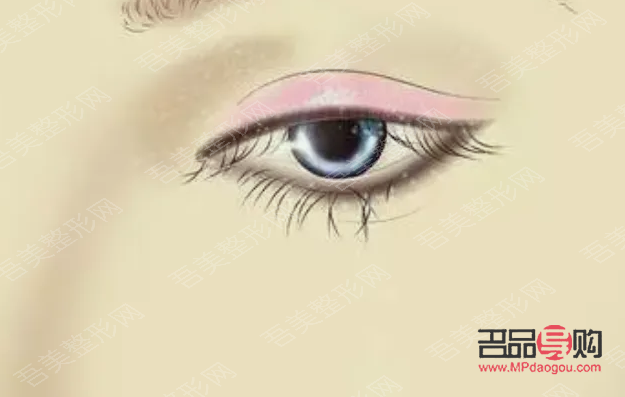 <h3>眼瞼重建術(shù)：重塑眼部輪廓，重拾自信之美</h3>