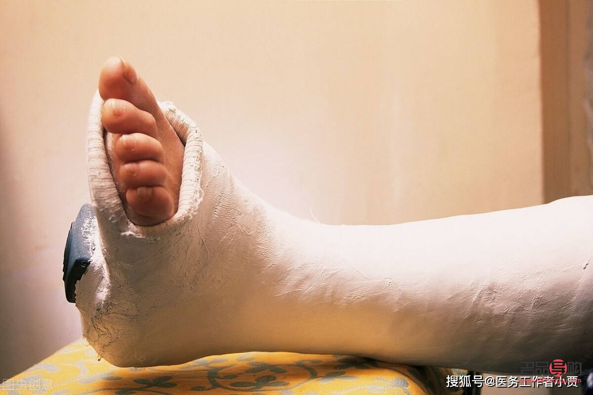 腳骨折能做身體護(hù)理嗎(腳骨折能做身體護(hù)理嗎視頻)