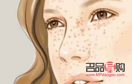 美容祛斑怎么(美容祛斑怎么做)