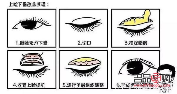 眼綜合七項(xiàng)包括哪些(眼綜合7項(xiàng))