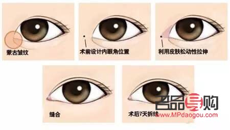 眼綜合七項包括哪些(眼綜合7項)