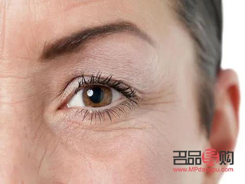 眼部干紋和細紋區(qū)別圖(眼部干紋和細紋區(qū)別圖片)