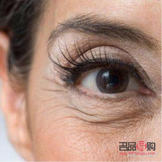 眼部干紋和細紋區(qū)別圖(眼部干紋和細紋區(qū)別圖片)