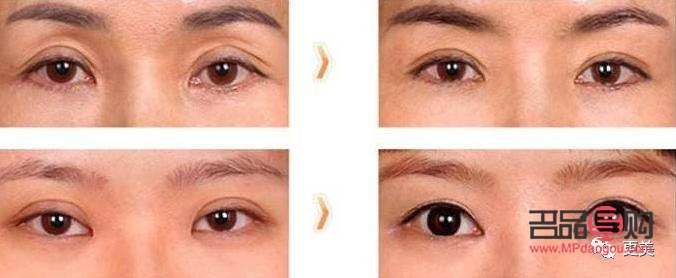 <h3>中國雙眼皮修復(fù)人：塑造美麗新傳奇</h3>