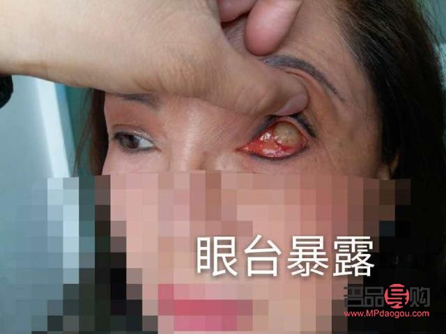 重慶義眼定做有哪些(重慶義眼定做有哪些地方)