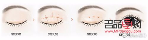 <h3>已有雙眼皮是否還能進(jìn)行埋線手術(shù)？</h3>