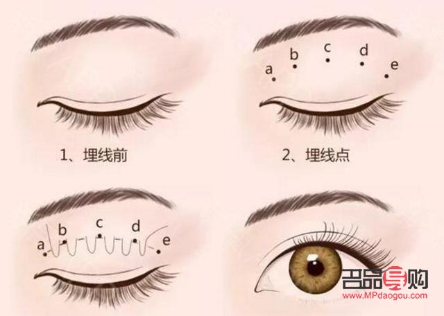 扇形雙眼皮顯老嗎(扇形雙眼皮顯老嗎圖片)