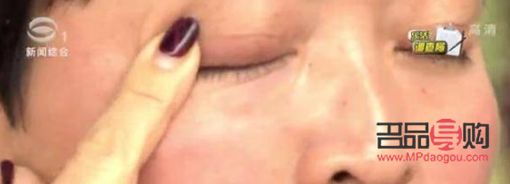 <h3>天生大小眼問題解析：女生是否能進(jìn)行矯正？</h3>