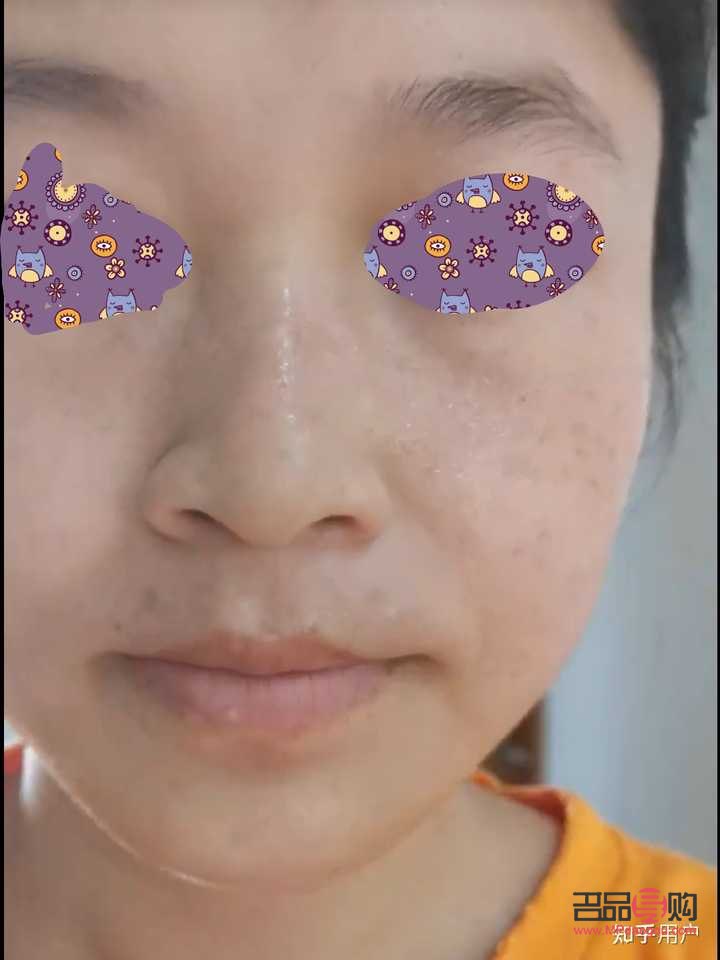 <h3>美容院祛雀斑效果好嗎？專業(yè)分析與建議</h3>